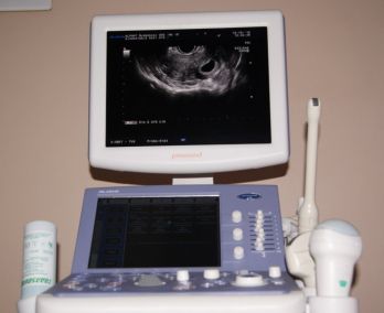 Ultrasonograf ALOKA