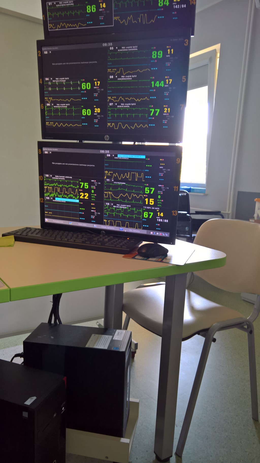 System monitoringu centrala kardiologiczna