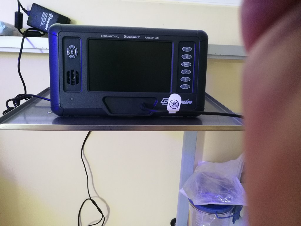 System do oceny regionalnej oksymetrii